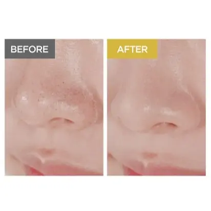 SKIN1004 Легка очищувальна олія з екстрактом центели азіатської, 30мл (тревел-версія)