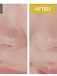 SKIN1004 Легка очищувальна олія з екстрактом центели азіатської, 30мл (тревел-версія)
