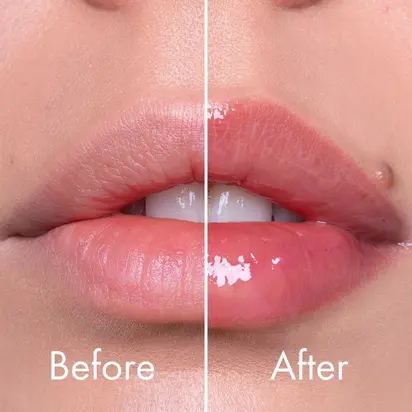 VT Cosmetics Інтенсивний плампер для губ з мікроголками (EXPERT) 4,3 г