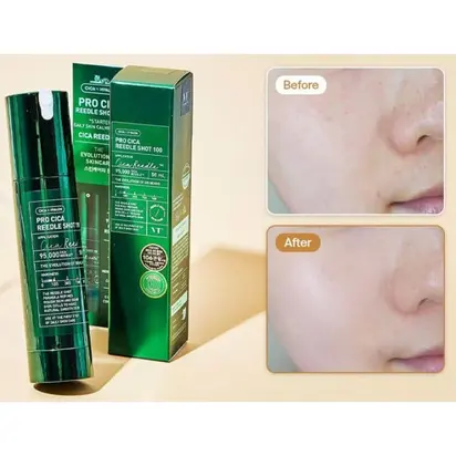 VT Cosmetics Бустер-сироватка з мікроголками для чутливої ​​шкіри (стік), 2 мл