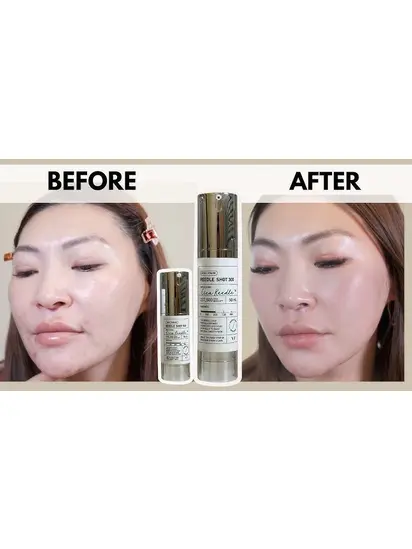 VT Cosmetics Мікроголковий бустер для покращення текстури шкіри, 50мл